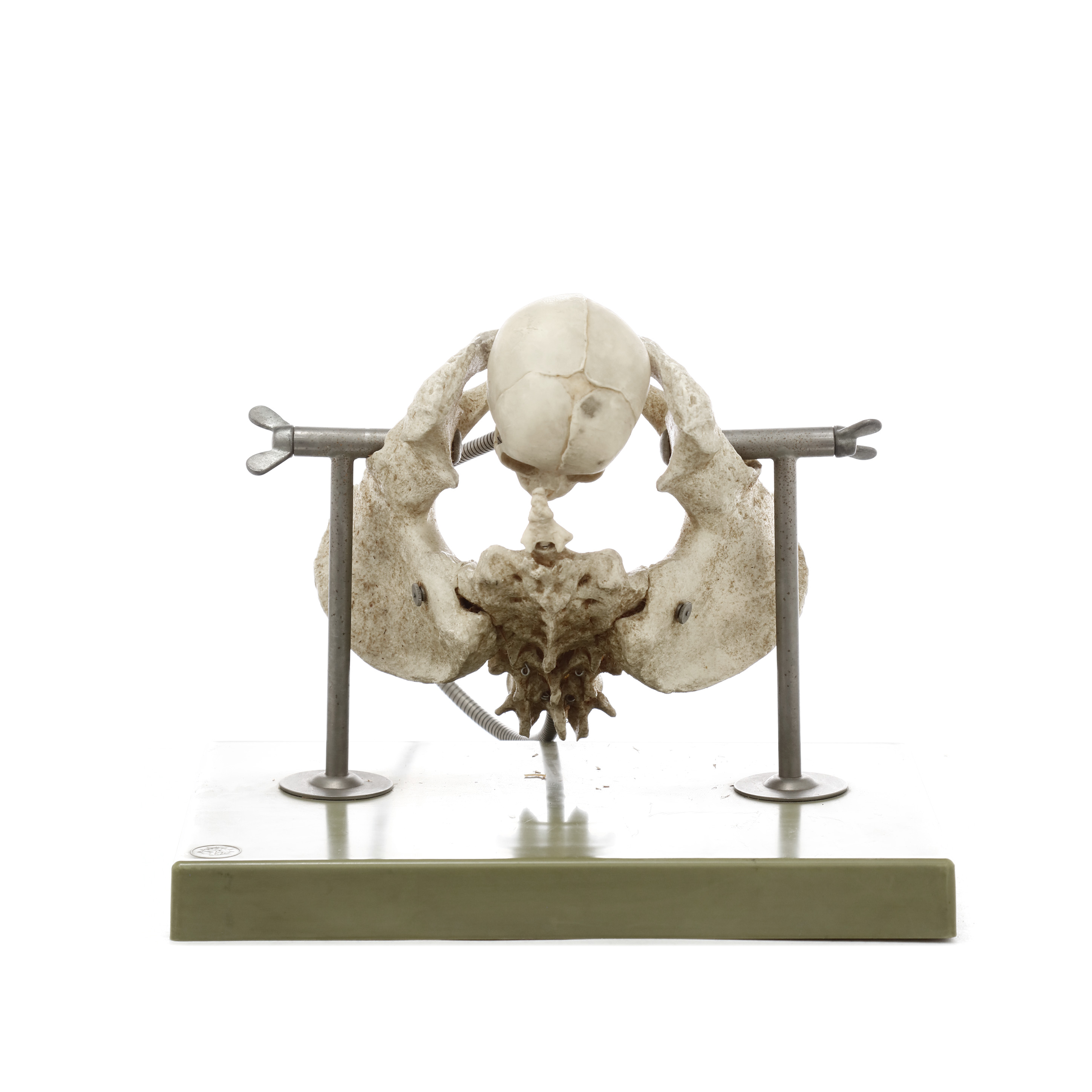 MODELO ANATÓMICO DE LA PELVIS Y CRÁNEO. SOMSO